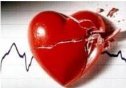 Enfermedades de las arterias coronarias | Recurso educativo 74815